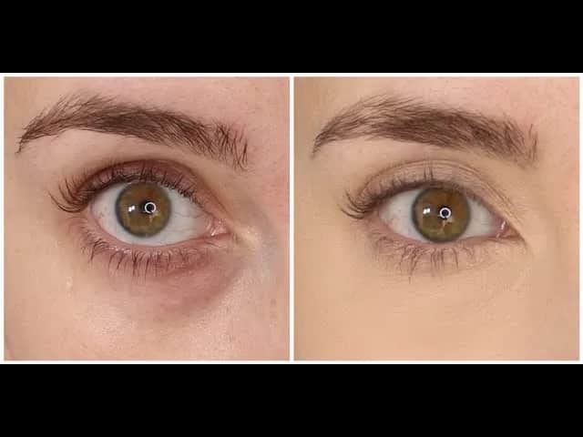 Jak zatuszować worki pod oczami? Makijaż krok po kroku!